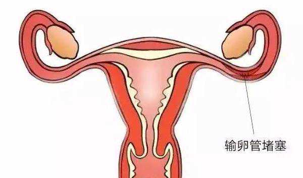 武汉60包男孩 2022年武汉有做供(借)卵试管婴儿的私立医院吗 ‘孕囊看男女怎么